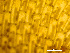  (Membranipora membranacea - HMSC174-03491)  @11 [ ] by-nc-sa  Unspecified Huntsman Marine Science Centre