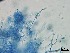  ( - Beauveria bassiana 136)  @11 [ ] CreativeCommons  Attribution Non-Commercial Share-Alike (2018) Julieta Tornesello G. Cepave, La Plata, Bs As, Argentina