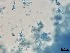  ( - Beauveria bassiana 148)  @11 [ ] CreativeCommons  Attribution Non-Commercial Share-Alike (2018) Julieta Tornesello G. Cepave, La Plata, Bs As, Argentina