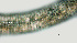  (Criconemoides sp. WI-TX - NID-N1143)  @11 [ ] CreativeCommons - Attribution Non-Commercial (2017) Tom Powers University of Nebraska