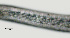  ( - NID-N2293)  @11 [ ] CreativeCommons - Attribution Non-Commercial (2017) Tom Powers University of Nebraska