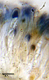  ( - DLH-2017-395)  @11 [ ] CreativeCommons  Attribution Non-Commercial Share-Alike (2020) Diane L. Haughland Unspecified