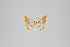  (Eois amarillada - GeoCR 35438)  @13 [ ] Copyright (2013) Gunnar Brehm Institut fuer Spezielle Zoologie und Evolutionsbiologie, Friedrich-Schiller Universität Jena
