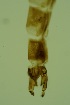  (Heleniella sp. 2ES - ZSM34342-C05)  @12 [ ] Unspecified (default): All Rights Reserved  SNSB, Staatliche Naturwissenschaftliche Sammlungen Bayerns ZSM (SNSB, Zoologische Staatssammlung Muenchen)