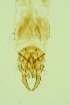  ( - ZSM34343-D03)  @11 [ ] Unspecified (default): All Rights Reserved  SNSB, Staatliche Naturwissenschaftliche Sammlungen Bayerns ZSM (SNSB, Zoologische Staatssammlung Muenchen)