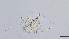  (Limnophyes bullus - HKU22)  @11 [ ] Copyright (2025) Mathew Stephen Seymour The University of Hong Kong