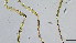  (Pseudorthocladius oyabecrassus - HKU52)  @11 [ ] Copyright (2025) Mathew Stephen Seymour The University of Hong Kong