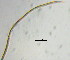  (Vasostoma - OUCJ010101N)  @11 [ ] CreativeCommons - Attribution Non-Commercial Share-Alike (2022) Hong Zhou Ocean University of China