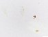  (Idiophlebotomus - JSDNP274)  @11 [ ] Unspecified (default): All Rights Reserved (2016) Jedsada Sukantamala Naresuan University