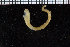  ( - ZMBN_106775)  @11 [ ] CreativeCommons - Attribution Non-Commercial Share-Alike (2015) University of Bergen University of Bergen, Natural History Collections