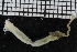  (Sosane sp - ZMBN_106997)  @11 [ ] CreativeCommons - Attribution Non-Commercial Share-Alike (2016) University of Bergen University of Bergen, Natural History Collections