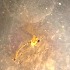  ( - BOLD-0DHZJK4Y1)  @11 [ ] Copyright (2018) LifeScanner Unspecified