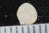  ( - ZMBN_125172)  @11 [ ] CreativeCommons - Attribution Non-Commercial Share-Alike (2018) University of Bergen Natural History Collections
