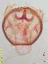  ( - RMNH.INS.25160)  @11 [ ] CreativeCommons  Attribution Non-Commercial Share-Alike (2020) Erik J. van Nieukerken-Naturalis Naturalis Biodiversity Center