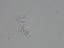  (Cladosporiales - TRa2023-143_NMF138_Culture)  @11 [ ] by-sa (2025) Norwegian marine fungi UiT The Arctic University of Norway