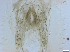  (Psectrocladius bisetus - RMNH.5091657)  @11 [ ] CreativeCommons - Attribution Non-Commercial Share-Alike (2018) Unspecified Naturalis Biodiversity Center