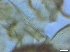  (Orthocladius rhyacobius - RMNH.INS.557384)  @11 [ ] CreativeCommons - Attribution Non-Commercial Share-Alike (2015) Unspecified Naturalis Biodiversity Center
