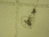  (Epiphanes sp - NZPL388)  @11 [ ] Copyright (2010) Unspecified Department of Biological Sciences, University of Waikato