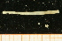  ( - UMBergen_NB_mald153)  @11 [ ] CreativeCommons - Attribution Non-Commercial Share-Alike (2013) Unspecified University of Bergen, Natural History Collections