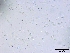  (Cryptosphaeria eunomia - O-F75330)  @11 [ ] CreativeCommons - Attribution Non-Commercial Share-Alike (2013) Teppo Rama Norwegian Institute for Nature Research (NINA)