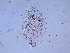  (Acanthococcus lagerstroemiae - SNU313)  @13 [ ] CreativeCommons - Attribution Share-Alike (2015) Unspecified Seoul National Uiversity