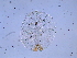  (Parthenolecanium fletcheri - SNU358)  @12 [ ] CreativeCommons - Attribution Share-Alike (2015) Unspecified Seoul National Uiversity