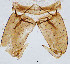  (Procladius sp. 4XL - sun278)  @11 [ ] CreativeCommons - Attribution Non-Commercial Share-Alike (2020) Xiaolong Lin College of Life Sciences, Nankai Unviersity