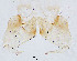  (Ablabesmyia sp. 10XL - sun311)  @11 [ ] CreativeCommons - Attribution Non-Commercial Share-Alike (2020) Xiaolong Lin College of Life Sciences, Nankai Unviersity