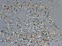  (Anoplotermes spinidotus - UF_PU255)  @11 [ ] Copyright (2014) Rudolf Scheffrahn University of Florida
