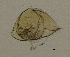  (Chydorus piger - BarCrust 106)  @12 [ ] CreativeCommons - Attribution Non-Commercial Share-Alike (2015) A. Hobæk Norwegian Institute for Water Research