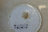  (Pteraster rugatus - ADP3-S121-MT2-2)  @11 [ ] CreativeCommons - Attribution (2015) Unspecified Universite Libre de Bruxelles