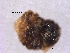  ( - Hedaya95)  @11 [ ] Copyright (2013) Dr. Hosam Elansary Alexandria University