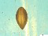  (Sphaerium rhomboideum - BSC-50.3)  @11 [ ] CreativeCommons - Attribution Non-Commercial (2019) Susan Daniel Great Lakes Center