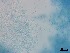  ( - Isaria fumosorosea 032)  @11 [ ] CreativeCommons  Attribution Non-Commercial Share-Alike (2018) Julieta Tornesello G. Cepave, La Plata, Bs As, Argentina