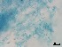  ( - Isaria fumosorosea 303)  @11 [ ] CreativeCommons  Attribution Non-Commercial Share-Alike (2018) Julieta Tornesello G. Cepave, La Plata, Bs As, Argentina