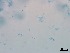  ( - Isaria fumosorosea 309)  @11 [ ] CreativeCommons  Attribution Non-Commercial Share-Alike (2018) Julieta Tornesello G. Cepave, La Plata, Bs As, Argentina