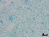  ( - Isaria fumosorosea 315)  @11 [ ] CreativeCommons  Attribution Non-Commercial Share-Alike (2018) Julieta Tornesello G. Cepave, La Plata, Bs As, Argentina