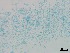  (Cordyceps - Isaria fumosorosea 316)  @11 [ ] CreativeCommons  Attribution Non-Commercial Share-Alike (2018) Julieta Tornesello G. Cepave, La Plata, Bs As, Argentina