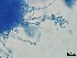  ( - Beauveria bassiana 418)  @11 [ ] CreativeCommons  Attribution Non-Commercial Share-Alike (2018) Julieta Tornesello G. Cepave, La Plata, Bs As, Argentina