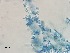  ( - Beauveria bassiana 572)  @11 [ ] CreativeCommons  Attribution Non-Commercial Share-Alike (2018) Julieta Tornesello G. Cepave, La Plata, Bs As, Argentina