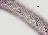  ( - NID-N244)  @11 [ ] CreativeCommons - Attribution Non-Commercial (2017) Tom Powers University of Nebraska
