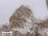  (Chaenothecopsis parasitaster - MCM466_ABMI09)  @11 [ ] CreativeCommons  Attribution Non-Commercial Share-Alike (2025) Diane L. Haughland Unspecified