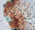  ( - DLH-2017-725)  @11 [ ] CreativeCommons  Attribution Non-Commercial Share-Alike (2020) Diane L. Haughland Unspecified