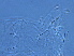  (Neodicrothrix - YN481-2)  @11 [ ] CreativeCommons - Attribution Non-Commercial Share-Alike (2020) Unspecified Nanjing Agriculture university