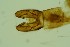  (Metriocnemus sp. 4SW - ZSM34342-B10)  @11 [ ] Unspecified (default): All Rights Reserved  SNSB, Staatliche Naturwissenschaftliche Sammlungen Bayerns ZSM (SNSB, Zoologische Staatssammlung Muenchen)