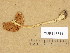  (Volvariella caesiotincta - TUR145611)  @11 [ ] Copyright (2014) Diana Weckman Botanical Museum, Finnish Museum of Natural History, University of Helsinki