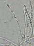  ( - FDS-CA-03807)  @11 [ ] by-nc (2024) Stu Pickell Fungal Diversity Survey