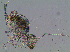  (Disparrhopalites patrizii - Desq22CO14_C01)  @11 [ ] CreativeCommons - Attribution Non-Commercial No Derivatives (2023) Ulrich Burkhardt Soil Organism Research