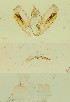  ( - BC ZSM Lep 84759)  @11 [ ] by-nc-sa (2023) SNSB, Staatliche Naturwissenschaftliche Sammlungen Bayerns ZSM (SNSB, Zoologische Staatssammlung Muenchen)