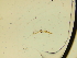  ( - BC ZSM Lep 84759)  @11 [ ] by-nc-sa (2022) SNSB, Staatliche Naturwissenschaftliche Sammlungen Bayerns ZSM (SNSB, Zoologische Staatssammlung Muenchen)